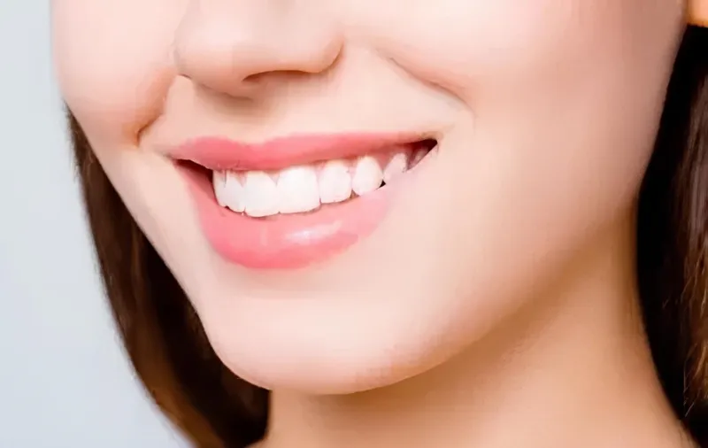 Blanchiment Dentaire en Tunisie