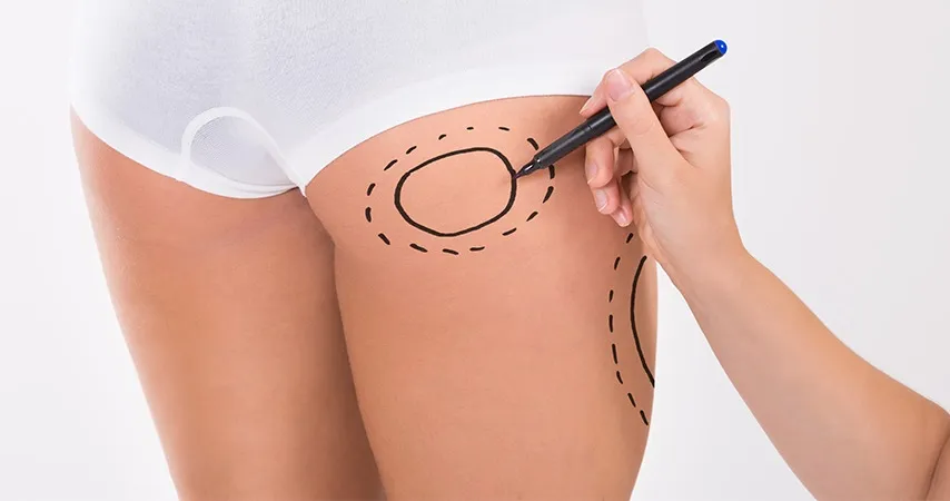 Implants des Fesses en Tunisie treatment visualization