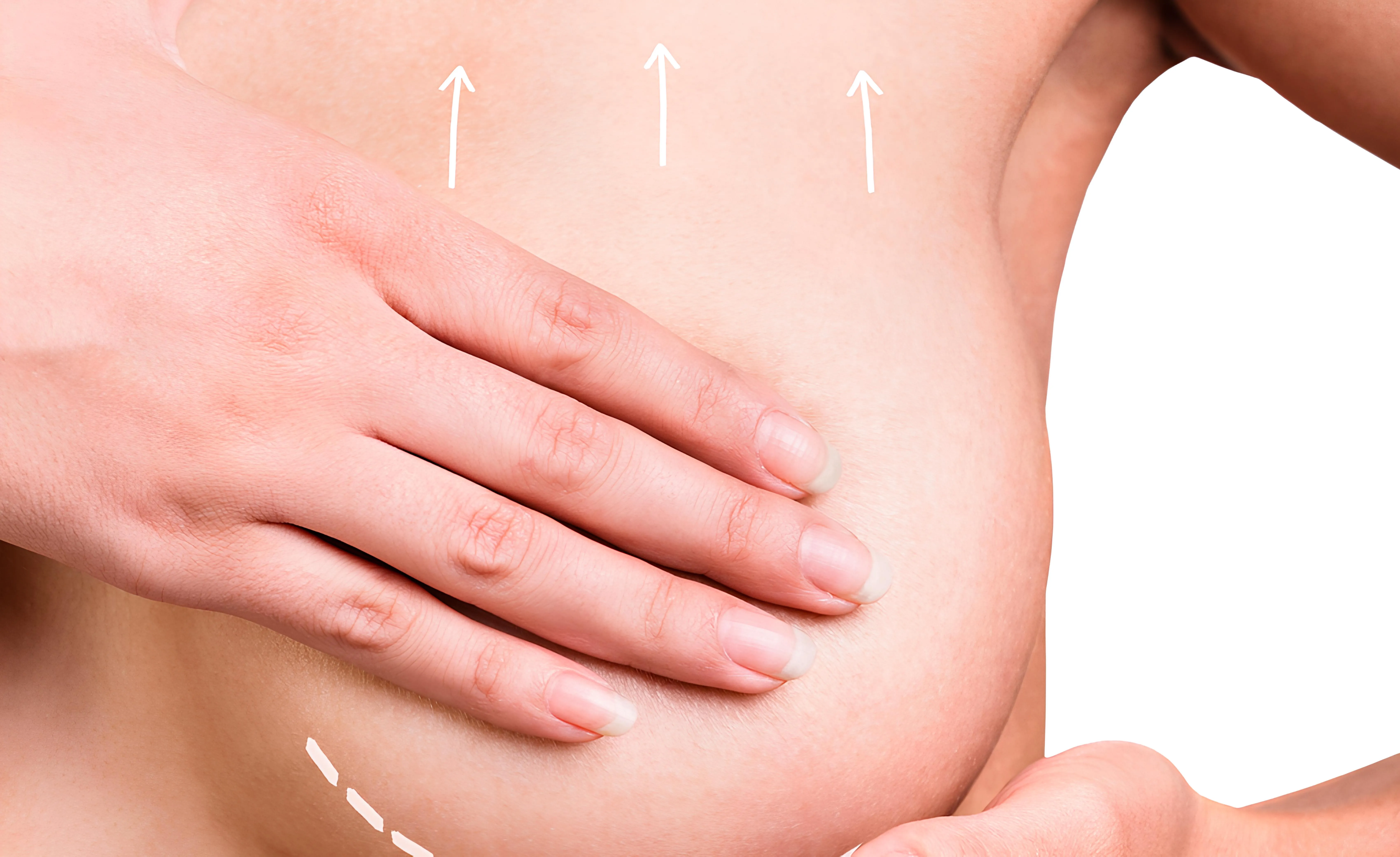 Lifting des Seins en Tunisie treatment visualization