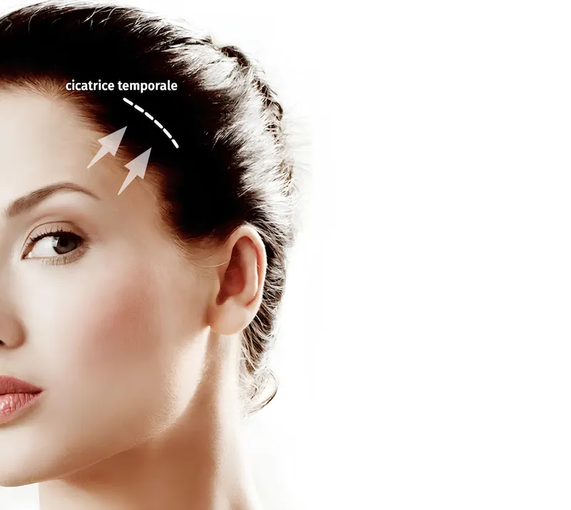 Lifting Temporal en Tunisie